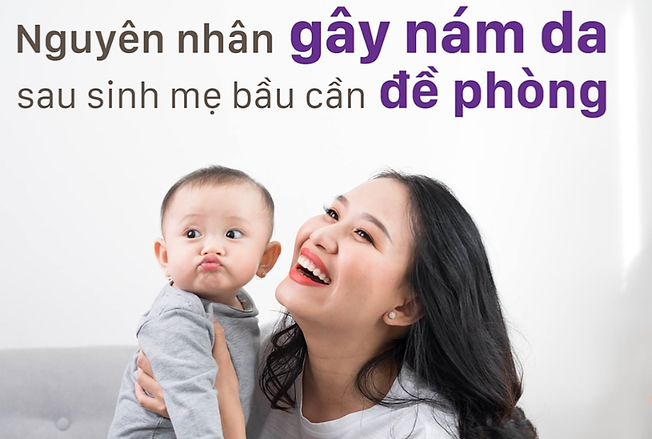 7 cách trị nám sau sinh hiệu quả từ thiên nhiên Nguyen-nhan-gay-nam-da-sau-sinh